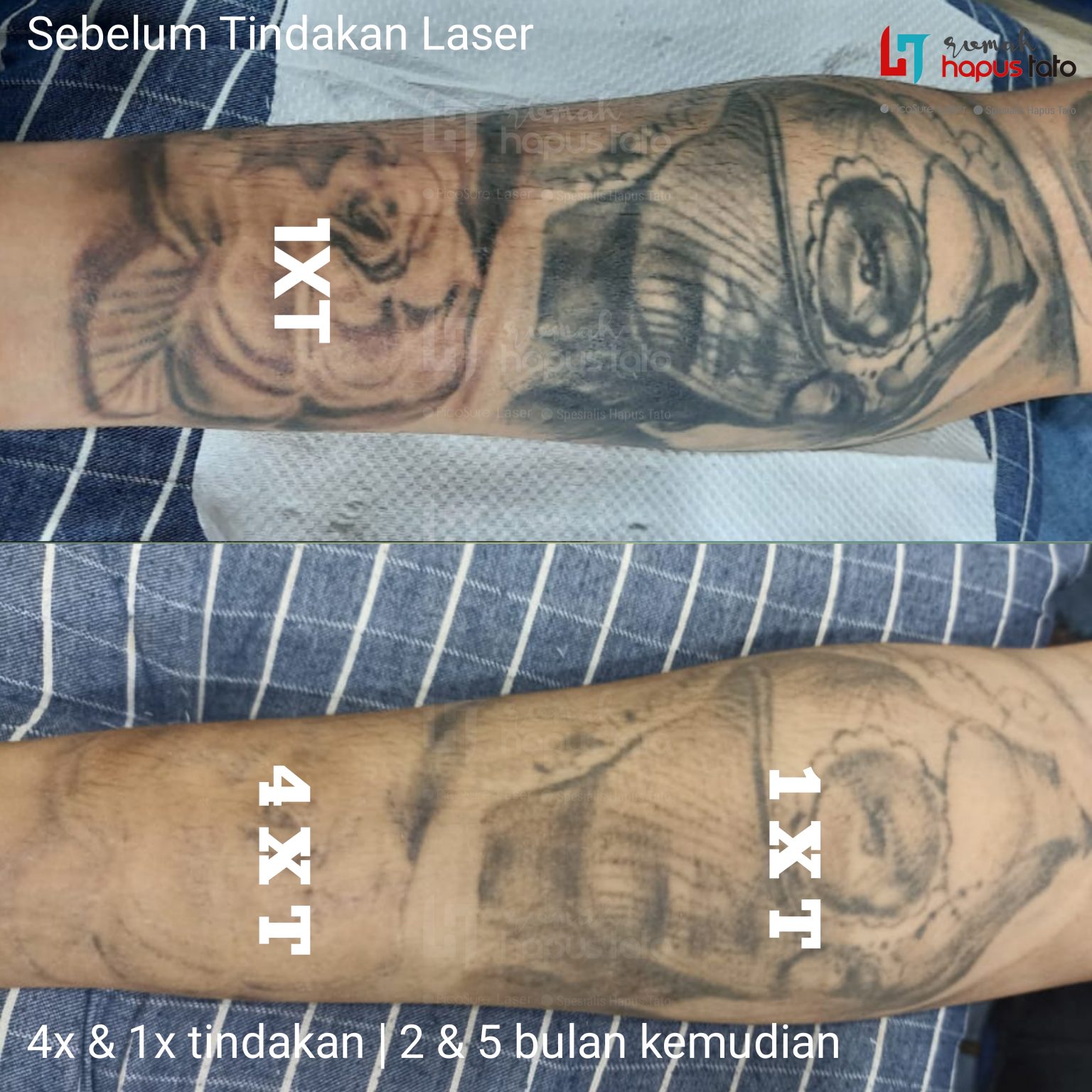 galeri_1